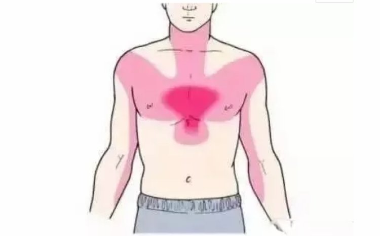 可在咽喉部,也可见于左前胸,甚至在下颌或剑突下上腹部,疼痛可以向左