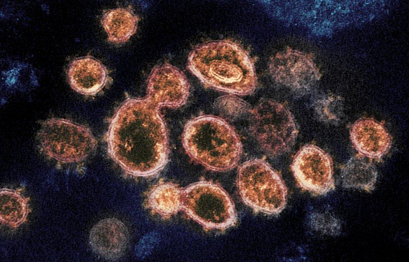当地时间本周四,美国卫生官员表示,在南非发现的一种新型冠状病毒变种