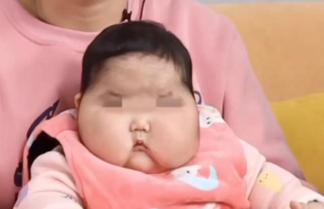 漳州回应“婴儿用抑菌霜成大头娃娃”：涉事企业暂停生产、产品下架