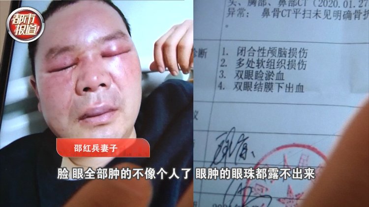 绝不护短!周口男子匿名举报污染被打致颅脑损伤!官方回应来了