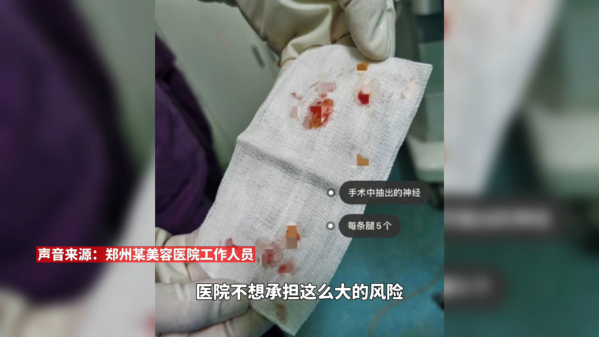 女孩为瘦腿切断小腿肌肉神经