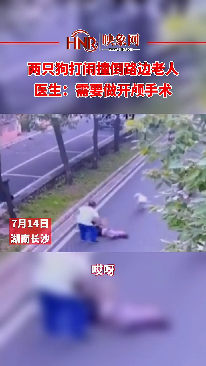 两只狗打闹撞倒路边老人 医生：需要做开颅手术