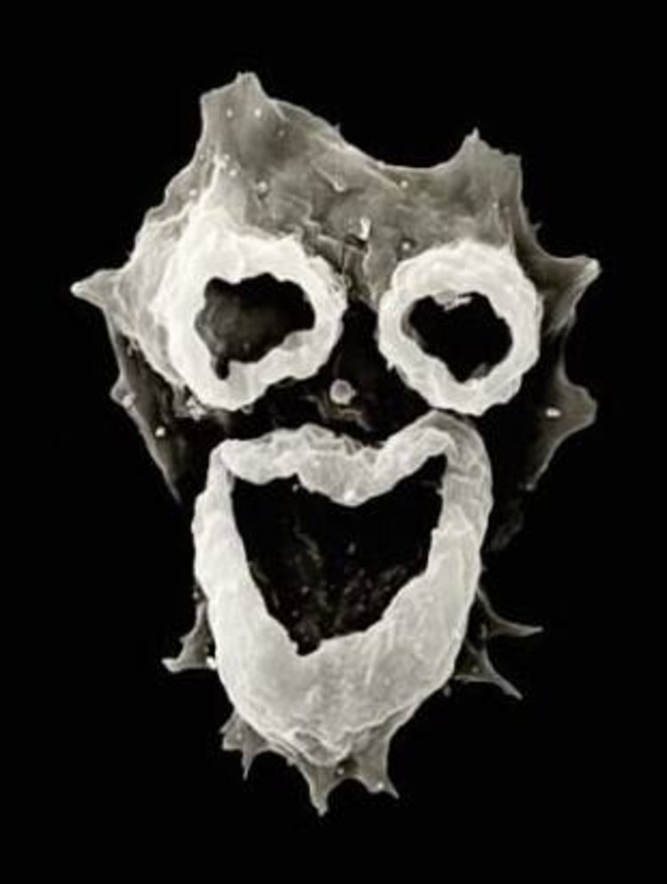 又见食脑变形虫可致人死亡美国佛罗里达州确诊1例