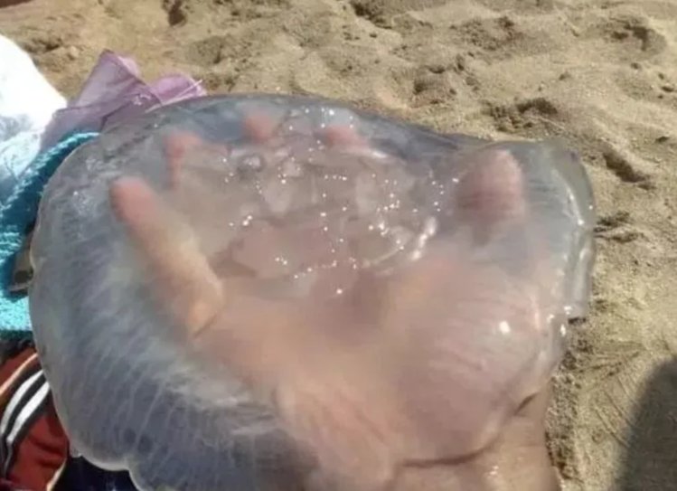 被海蜇蛰了以后的处理方法如下