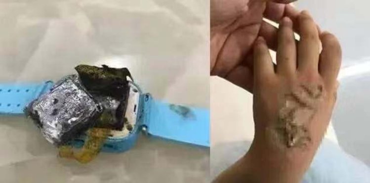 儿童电话手表突然自燃 选购攻略您做对了吗
